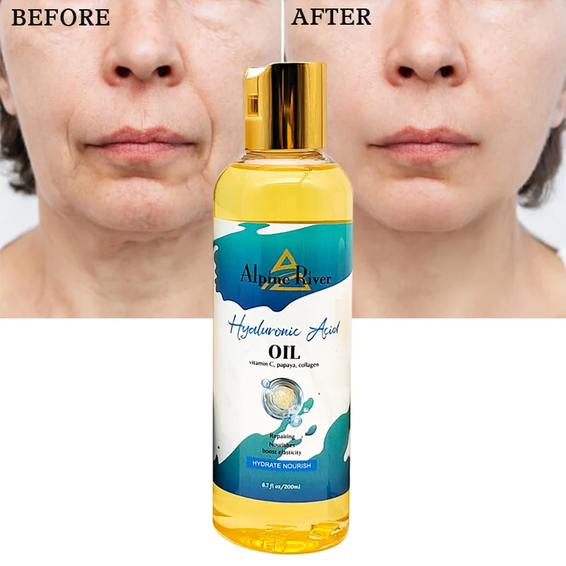 Private Label Alpine River 100% Natural Organic Vitamin C Papaya Hyaluronic Acid Skin Moisturizing Firming Skin Body Massage Oil