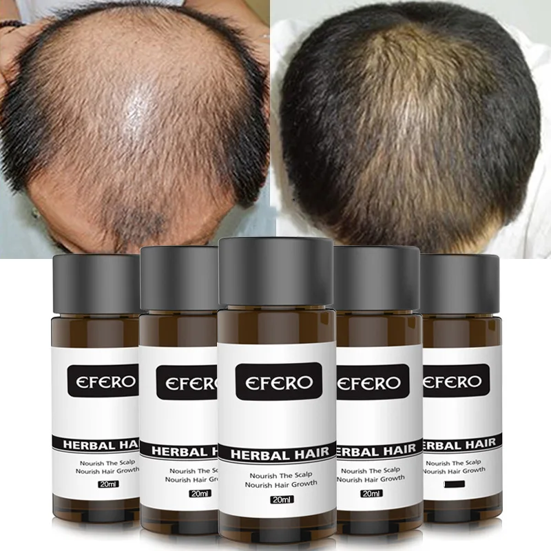 

EFERO 20ml Fast Powerful Hair Growth Oil Hair Loss Products Essential Oil Grow Restoration Growing Serum Hair Care