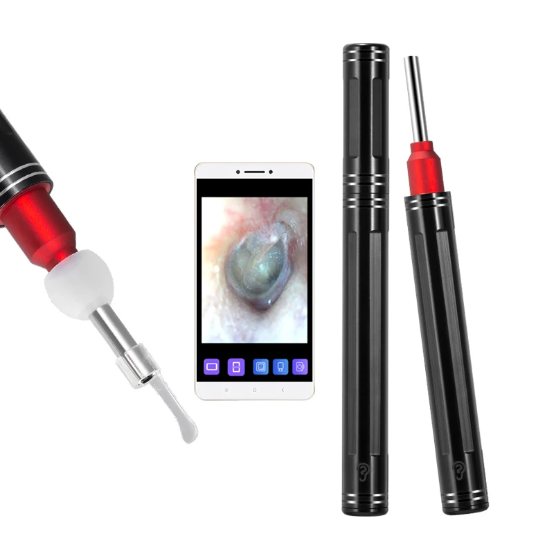 

Smart Orientation HD Visual Ear Camera Earwax Remover Tool, Black