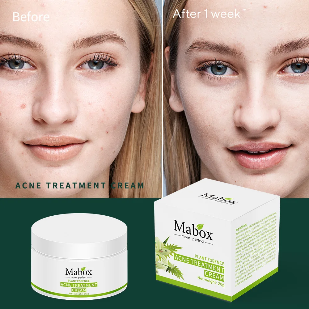 

Herbal Plant Extract Anti Pimple Cream Acne Treatment Cream