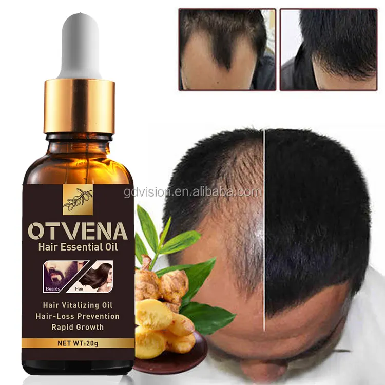 

Men Women Hair Oil Nourish Follicles Promote Obviously Faster Growth