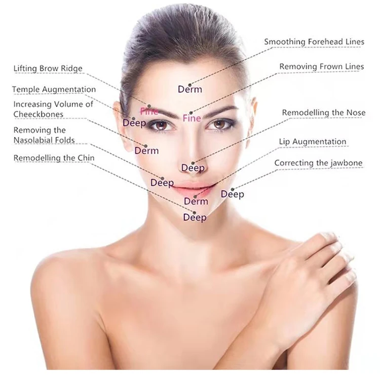 

2ml deep skin fillers nose plastic surgery Injectable hyaluronic acid dermal filler, Transparent
