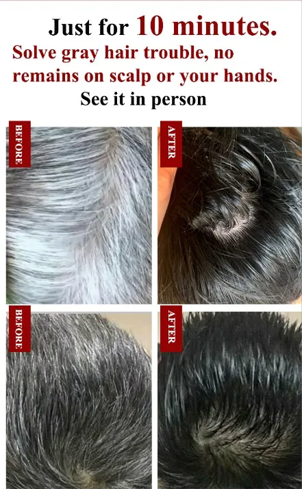 Yunnan Herbal Hair Dye A Black Hair Cream Turn White To Black Wash Color  Run Black Dew - Buy Young Hair Cream,Professional Hair Color Cream,Hair  Color Cream Permanent Product on 