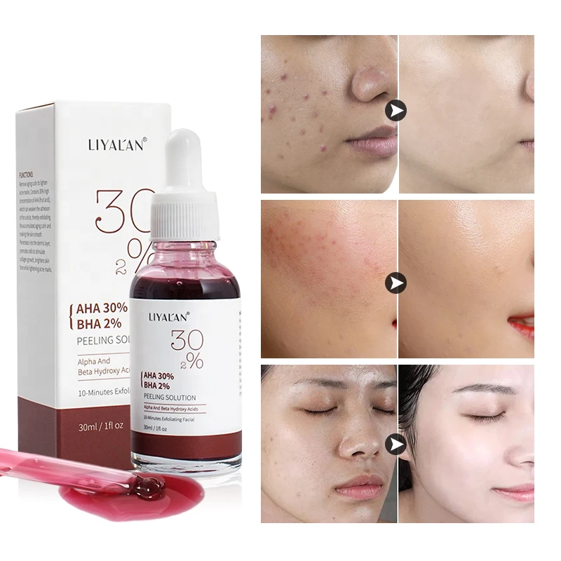 

OEM/ODM Private Label Facial Skin Care Whitening AHA 30% BHA 2% Peeling Solution Acne Face Serum