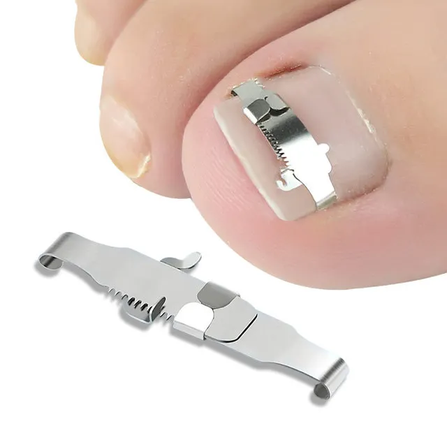 

1 pcs Stainless Steel Ingrown Toenail Correction Tool Pedicure Tools Foot Care Tool nail Straightening Buckle, Siliver