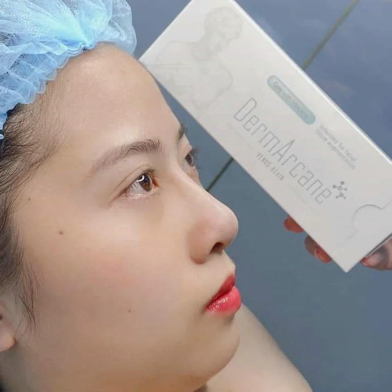 

Korea DermArcane HA concentration 24mg/ml Lido caine