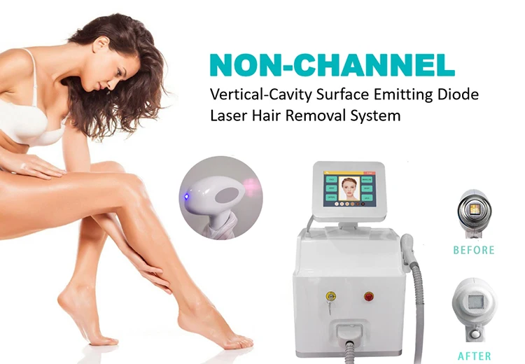 hair removal laser machine.jpg
