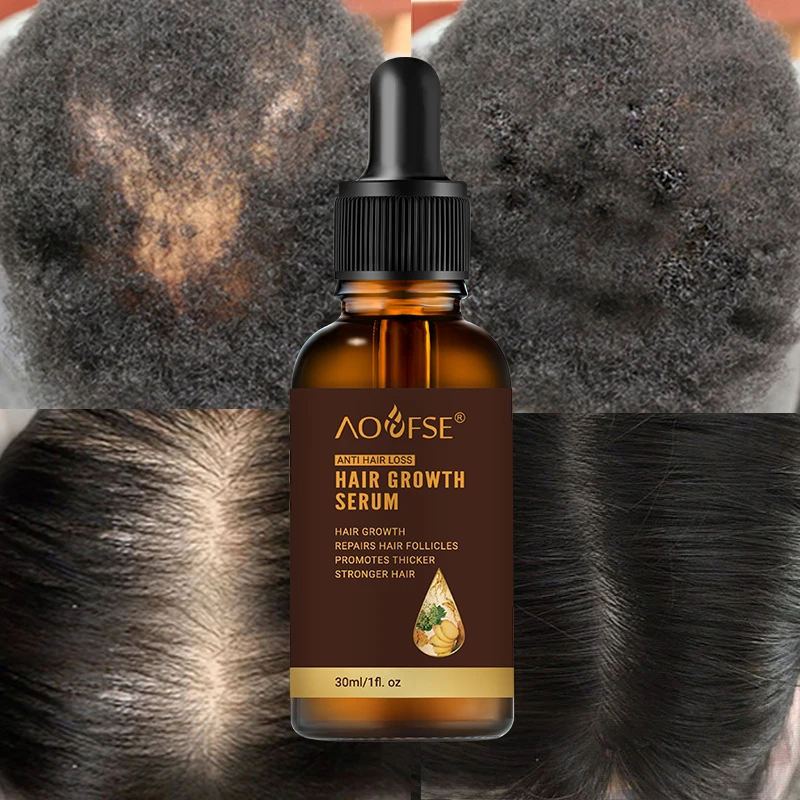 

Private Label Herbal Organic Ginger Hair Growth Oil Anti-hair Loss Treatment Natural Hair Growth Serum