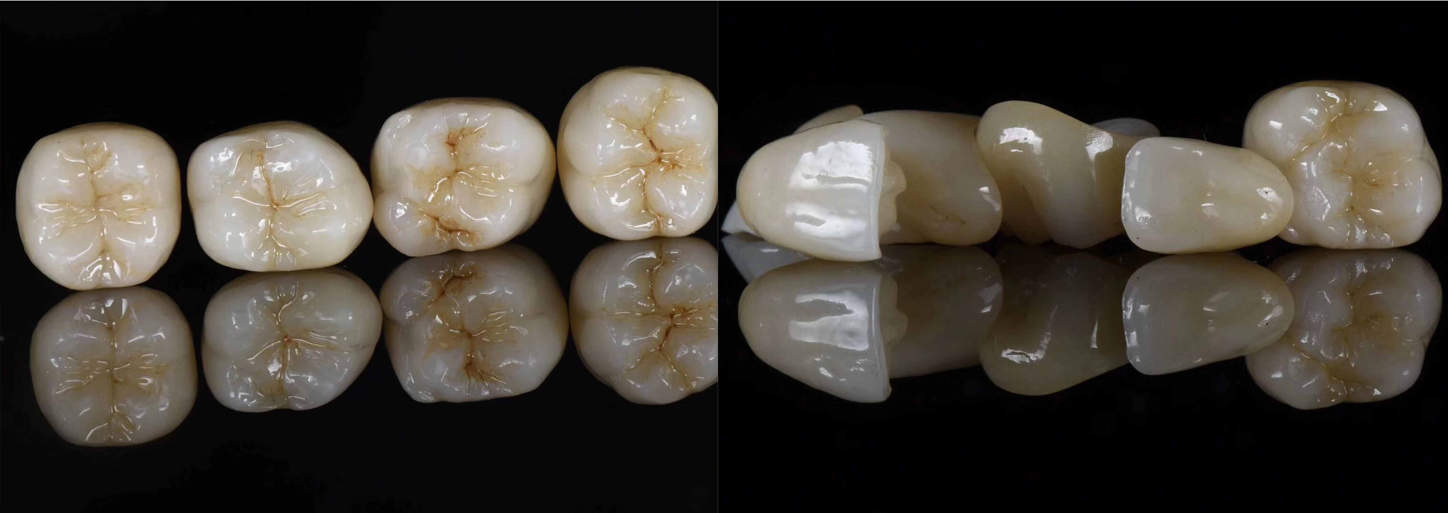 Yucera UT White Multilayer Construction Durable Ceramic Blocks the Dentist's Choice for Strength and Aesthetics
