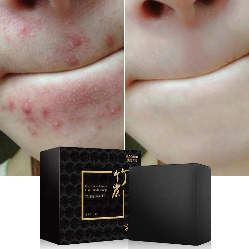 

Bamboo Charcoal Soap, Refreshing, Cleansing, Oil Control, and Blackhead Soap