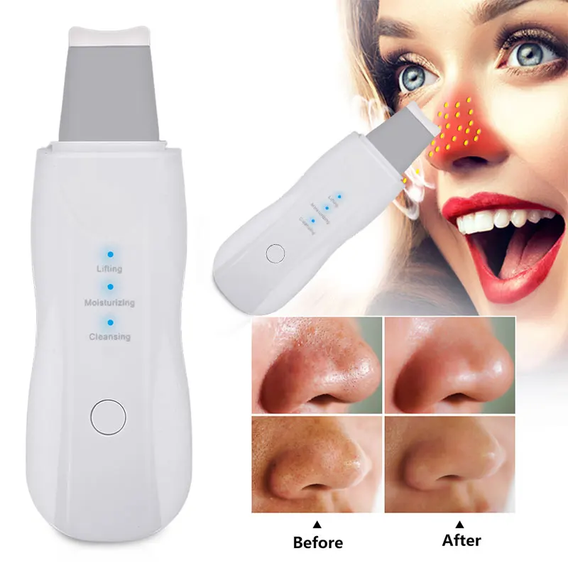 

Hot Sale Wholesale Ultrasonic Skin Scrubber Remove Dirt Blackhead Reduce USB Beauty Personal Care Skin Scrubber Beauty Care Tool