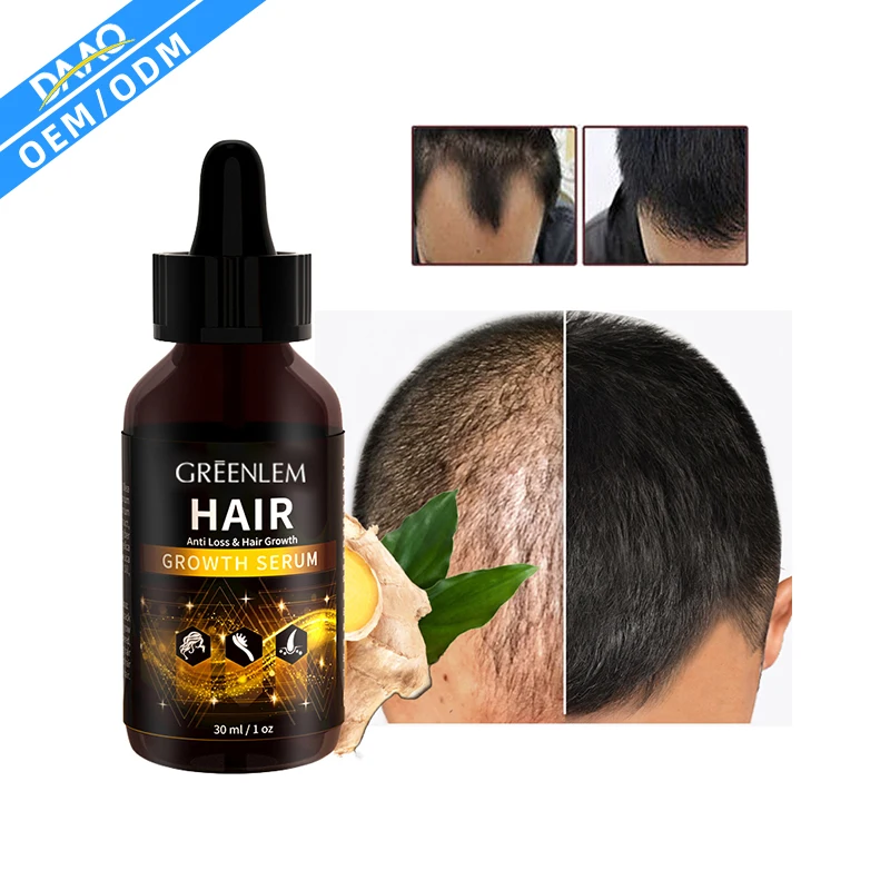 

DAAO In Stock Wholesale Ginger Oil 7 Days Hair Growth Essential Oil For Hair Loss Treatment Regrowth Serum