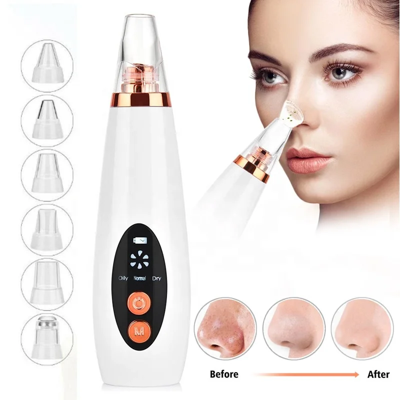 

High Quality OEM ODM Blackhead Remover Suction Machine Electric Facial Pore Cleaner Blackhead Remover Vacuum, White