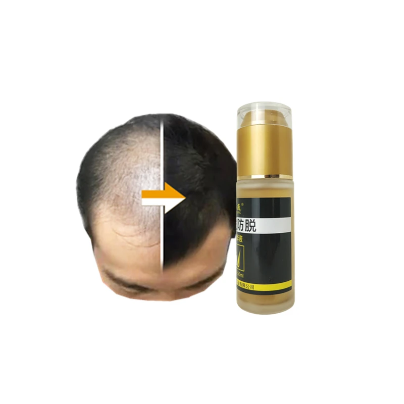 

Wholesale ayurveda hair care loss dubai do you hav magical hair growth treatment oil
