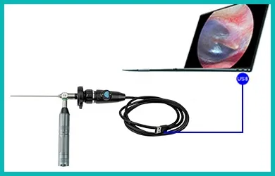 portable endoscope