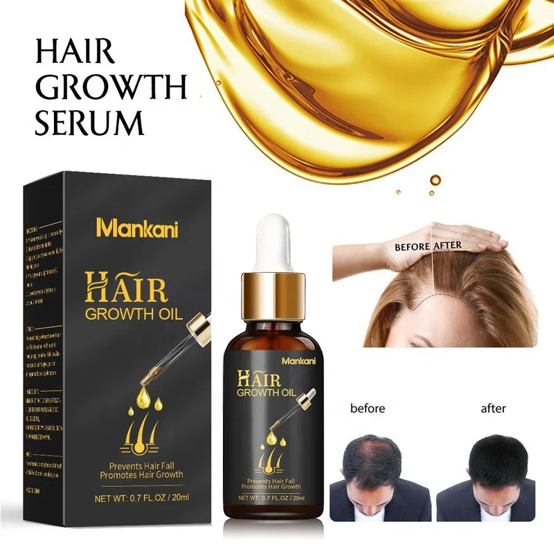 

hair rapid growth oil supplier herbal care organic men women private label hair growth serum, Brown liquid