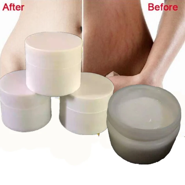 

Best Stretch Mark Removal Cream with Wholesale Price