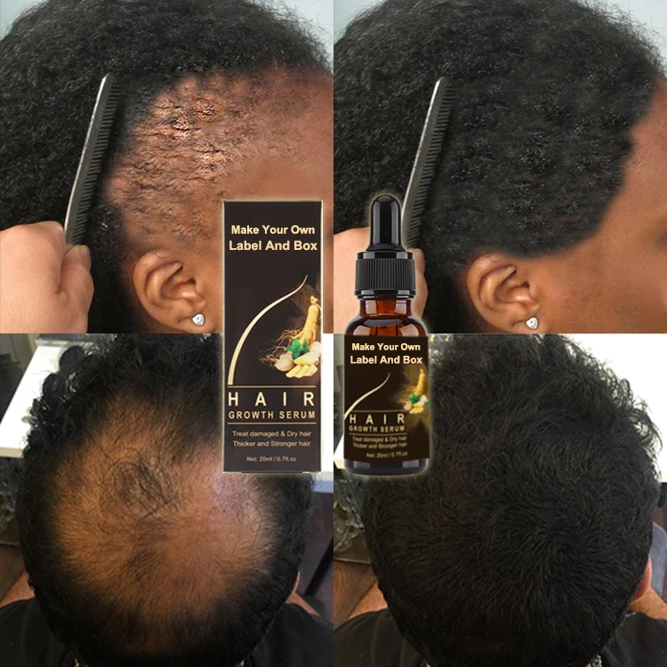 

Wholesale Private Label 100% Natural Organic Formula Nourishing Scalp Elixirs Hair Care Loss Treatment Hair Growth Oil Serum