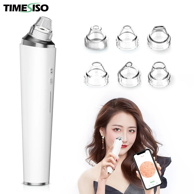 

Timesiso H100 machines remove blackheads facial cleaning blackhead removal, White/green/pink