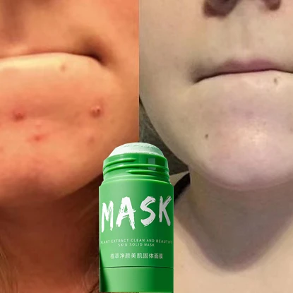 

Green Tea Smear cleansing OEM to remove acne, control oil, shrink pores, and collect lazy