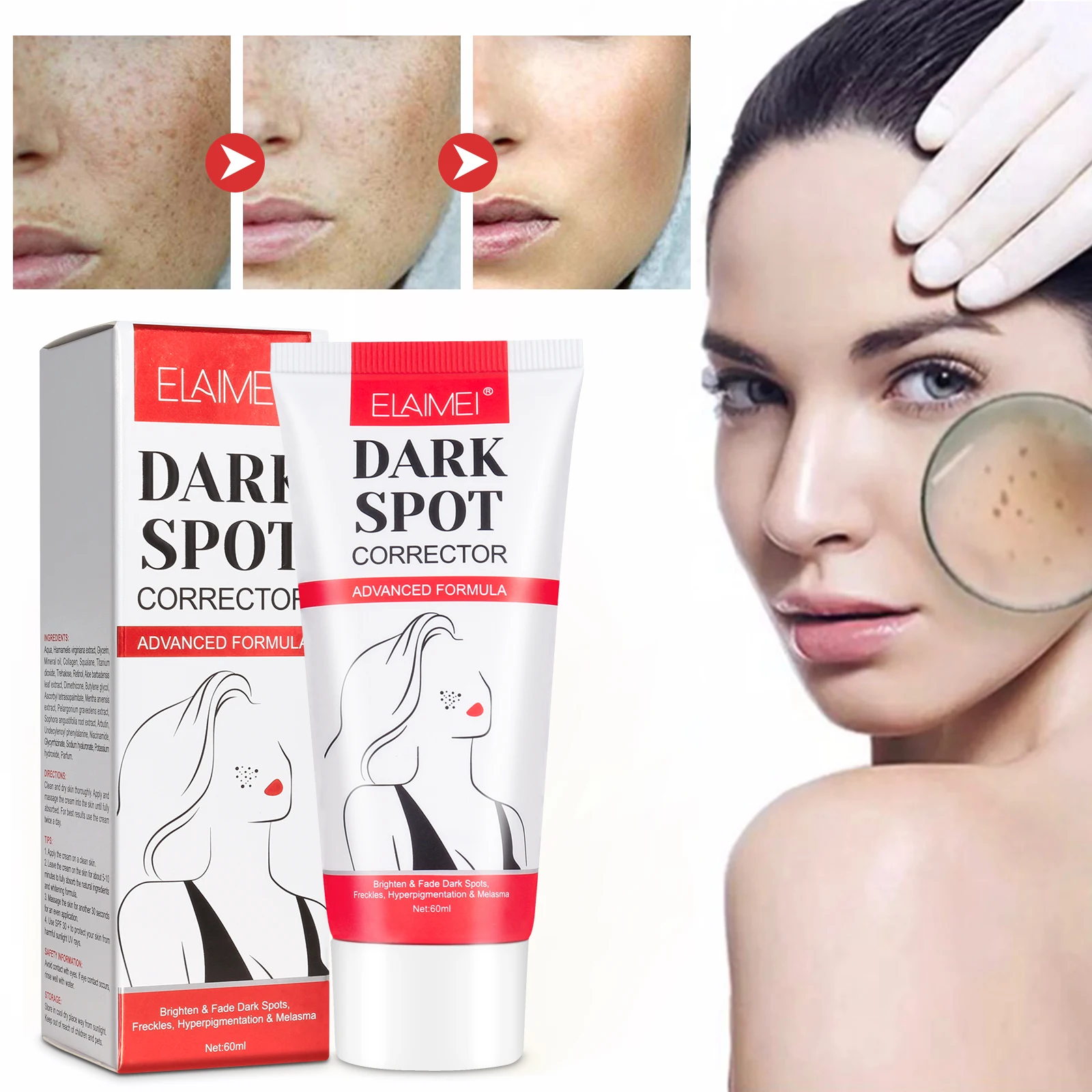 

ELAIMEI moisturizing beauty anti wrinkle whitening freckles removal creamprivate label dark spot corrector remover cream