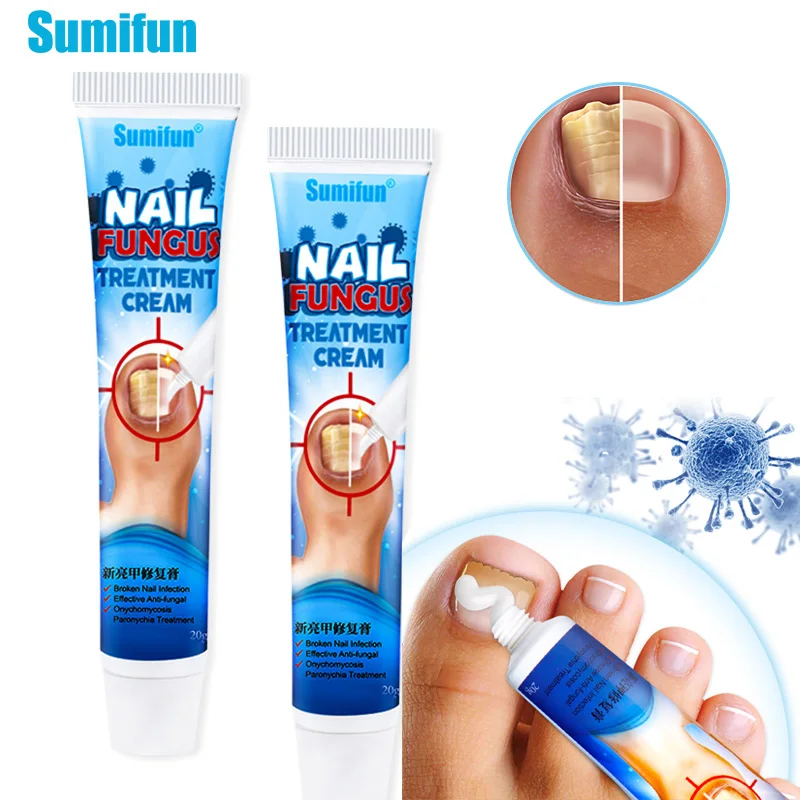 

Nail Fungus Removal Cream Onychomycosis Fungal Nail Treatment Paronychia Anti Infection Feet Toe Fungal Nail Care Ointment