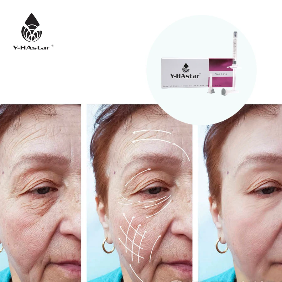 

Popular wrinkles resistance 5ml gel hyaluronic acid dermal filler