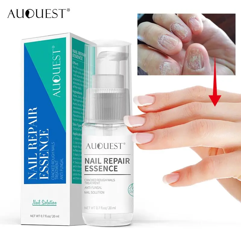 

AuQuest Nail Repair Liquid Cracked Rough Nails Treatment Anti Fungal Solution Foot Hand Scrub Finger Toe Foot Care