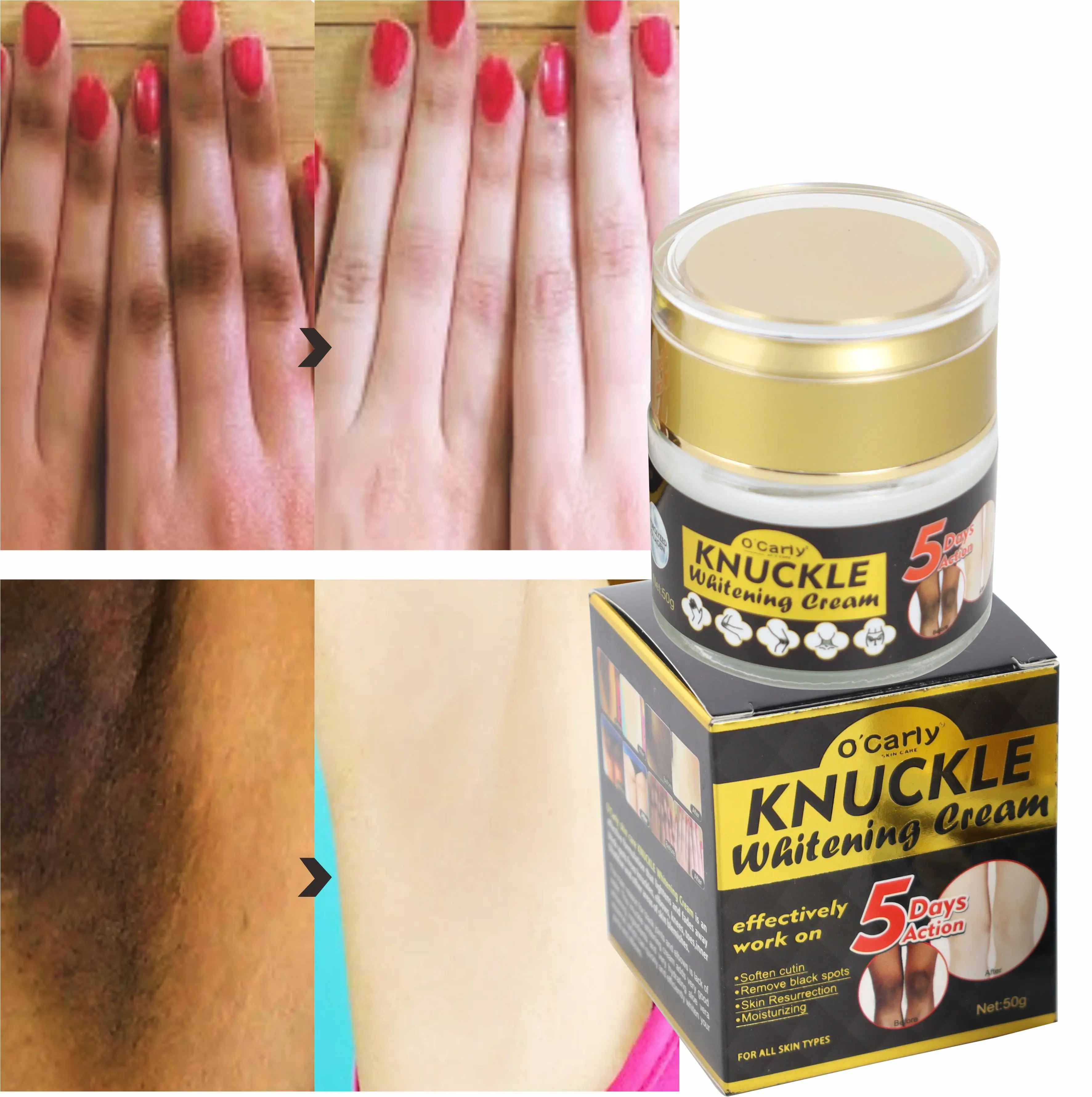 

Skincare (New) Private Label Hyaluronic acid Dark Knees Dark Elbows Lightening Skin Best Whitening Cream Dark Knuckles Removal