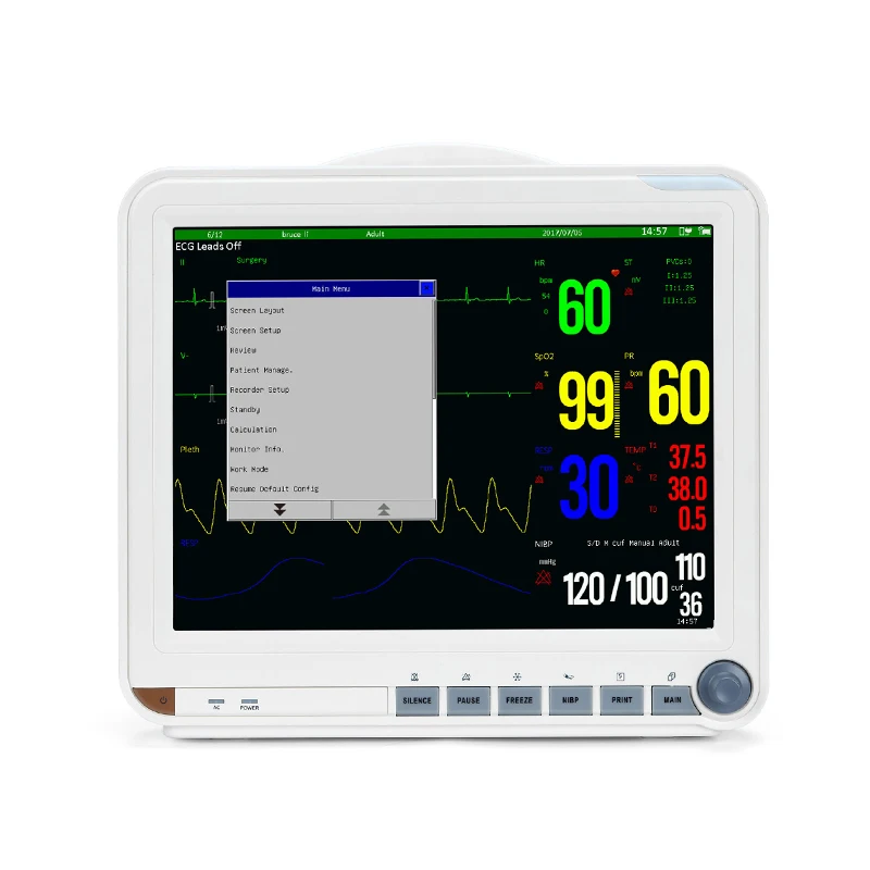 Monitor (3).jpg