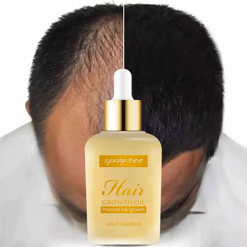 

Private Label men's Ginger Germinal Serum Oil Hair Loss Treatment Hair Growth Oil for men