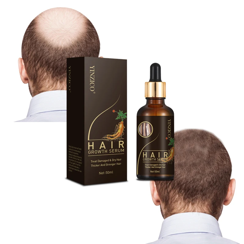 

neo hair growth lotion Biotin Serum Hair Treatment for Stronger Thicker Longer Hair Stop Thinning