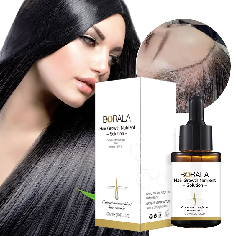 

OEM Private Label Effective Regrow Hair Naturally Herbal Hair Growth Serum Oil For Hair Regrowth Treatment