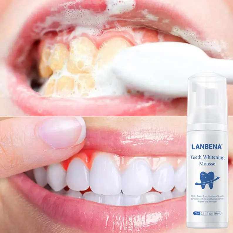

LANBENA dental consumables teeth whitening gel mousse tooth paste bleach cleaning tools stain remover Toothpaste oral