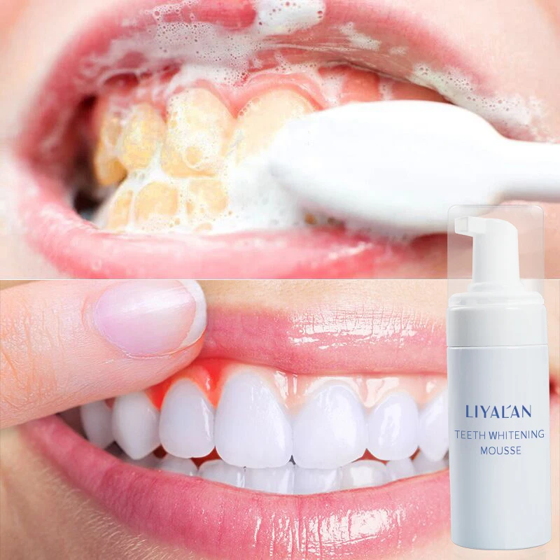 

Private Label Natural Oral Hygiene Foam Toothpaste White Teeth Cleanser Mousse Teeth Whitening Foam