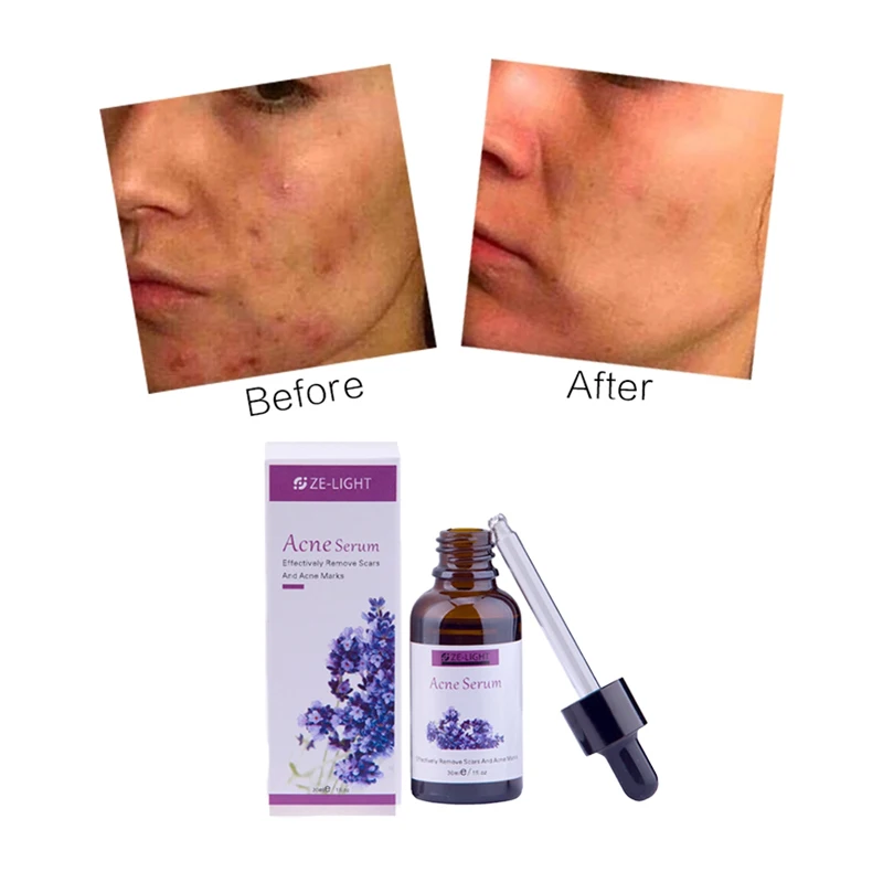 

Factory price acne serum liquid collagen snail repair whitening snail serum acne treatment face serum, Transparent