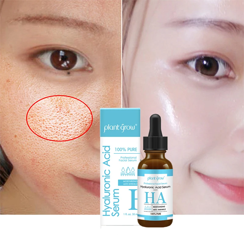 

IN STOCK Wholesale Skin Care Facial Serums Freckle Removal Acne Scars 20% Vitamin C Serum with Hyaluronic acid