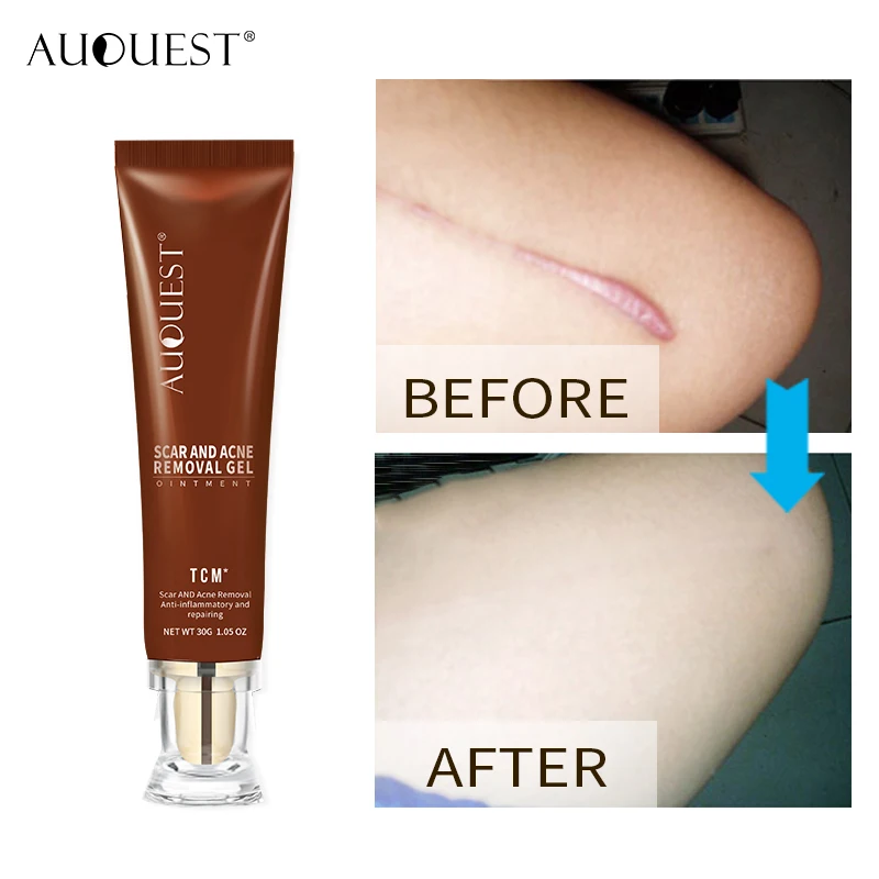 

Wholesale Best Selling Skin Care Dark Spot Lightening Face Acne Scar Removal Cream 30g