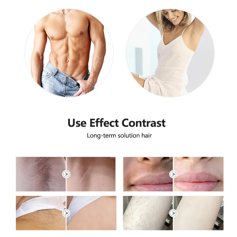 
Mini Portable Elight Shr Device Lazer Epilator Home Use Instrument Painless Permanent Laser Home Ipl Hair Removal From Home 