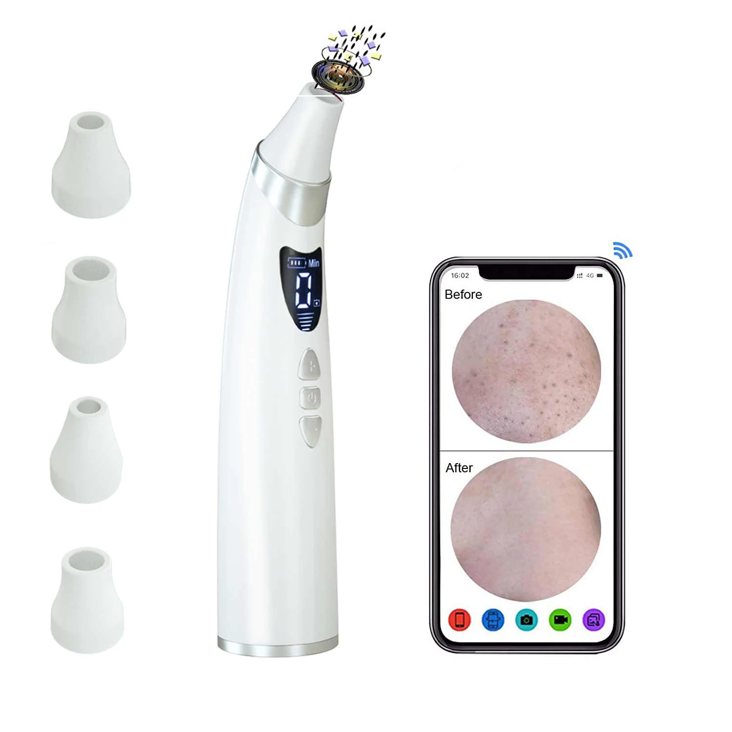 

2021 Hot Sale Machine Visual Removing Blackheads Pore Kit Tool Mini Vacuum Blackhead Remover, White