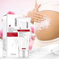 

Organic Natural Stretch Marks Remove Acne Scar Treatment Cream For Pregnancy Repairing Scars for Women Private label