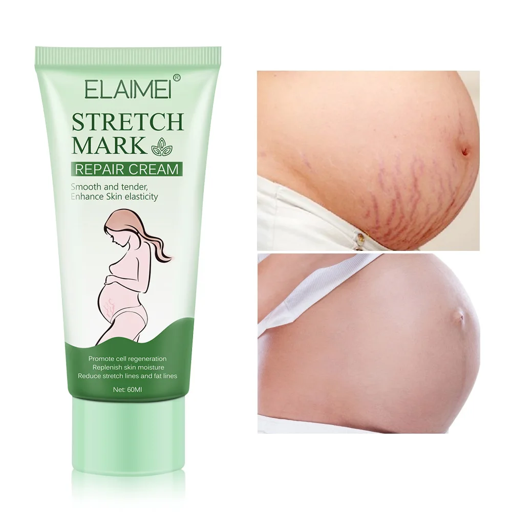 

Elaimei postpartum fat stretch line marks removing skin moisturizing smoothing repairing pregnancy stretch mark removal cream
