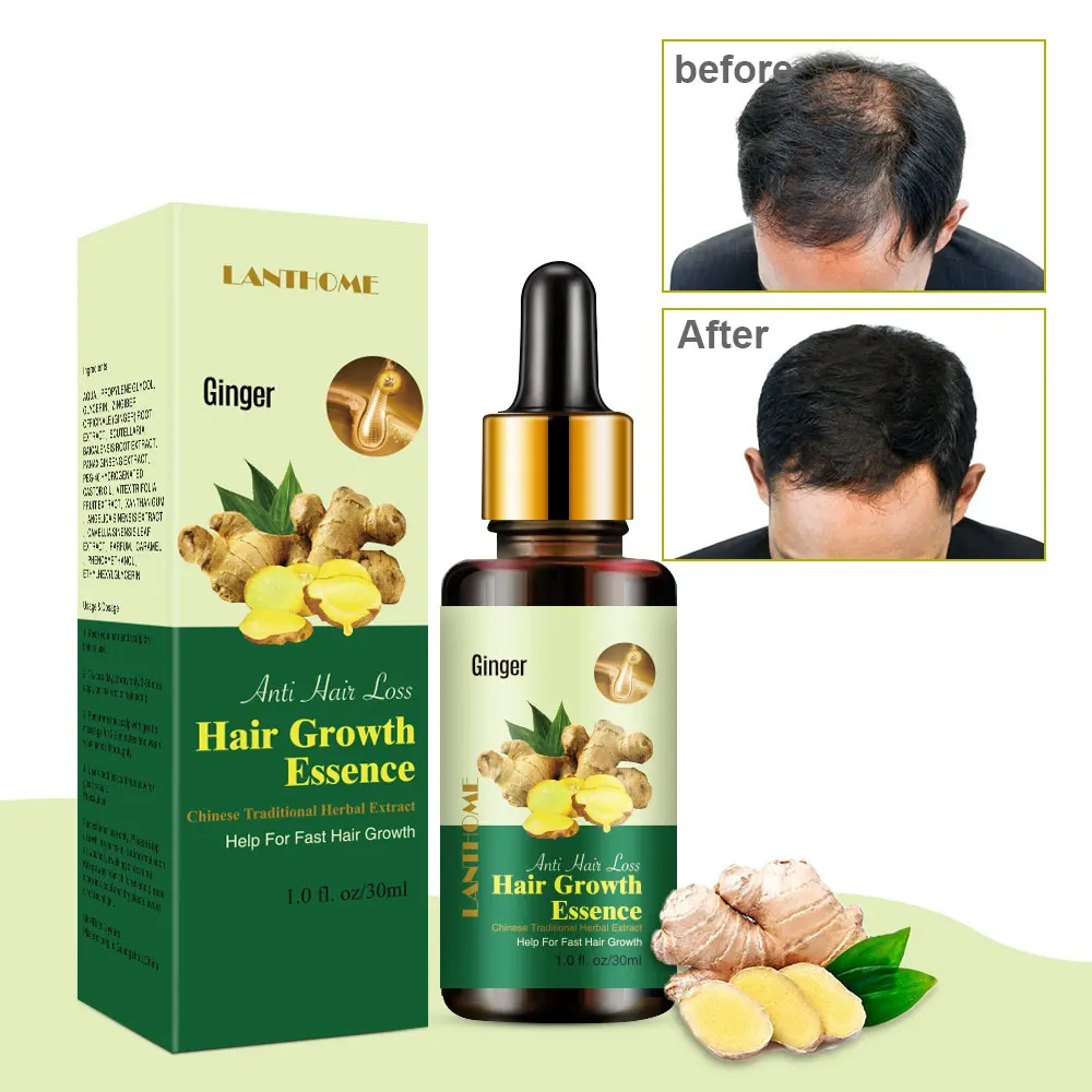 

30ml 7days Ginger Germinal Essential Oil Hair Growth Essence Hair Loss Treatment Serum Repair Liquid Dense Hair Fast Grow