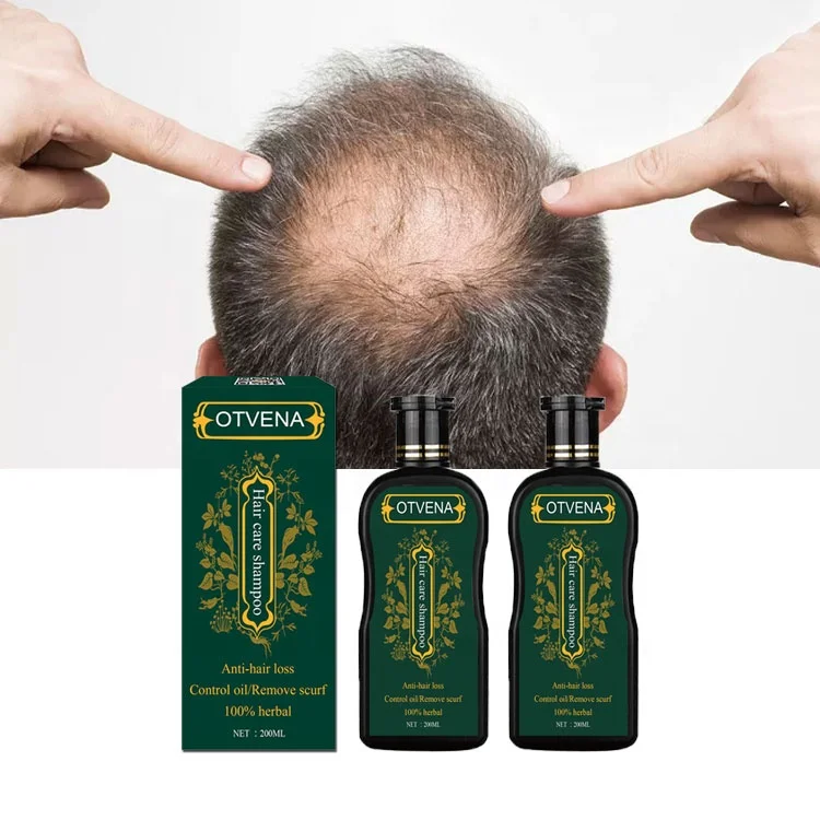 
Turkish most wanted men hair loss treatment anti hair fall shampoo  (62229007706)