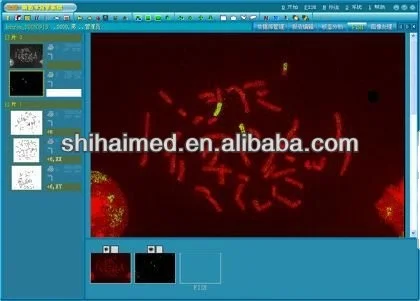
SH Chromosome Auto Karyotyping Image System 