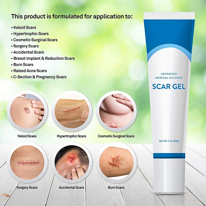 medical grade stretch mark cream