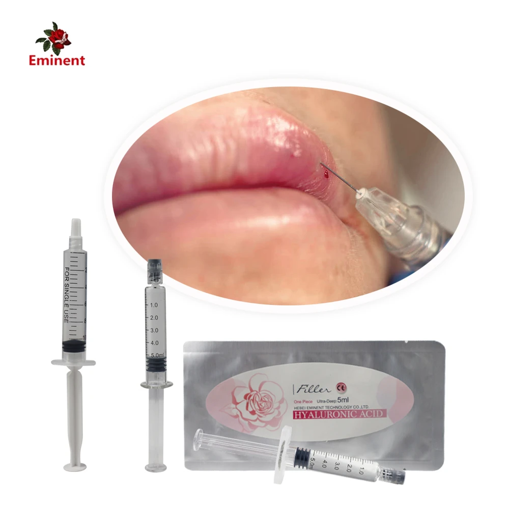 

injectable hyaluronic acid dermal filler/hyaluronic acid dermal filler lip/penile enlargement with dermal filler butt