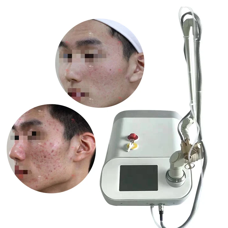 

Hot Sale Scar Removal Skin Tighten acne treatment co2 laser equipment Co2 Fractional Laser Beauty Machine