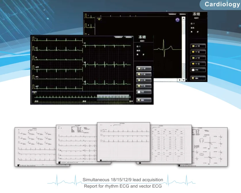 Medical Equipment Standard 18 Channels Digital ECG Machine for Hospital