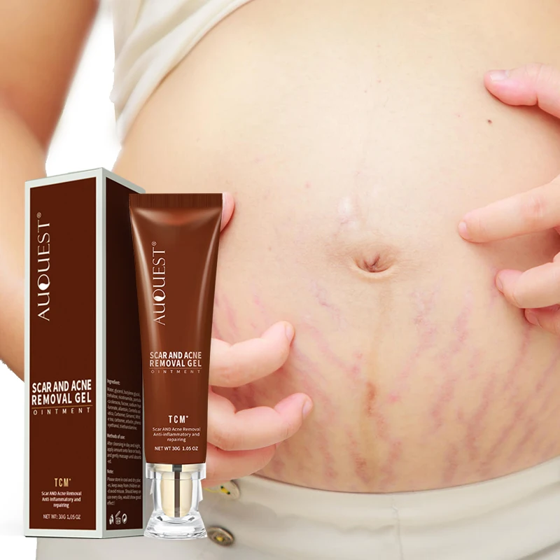 

Scar Light Cream Prevent Stretch Marks Even Skin Tone Tightening Firming Herbal Body Cream Scar Removal Cream, Transparent color